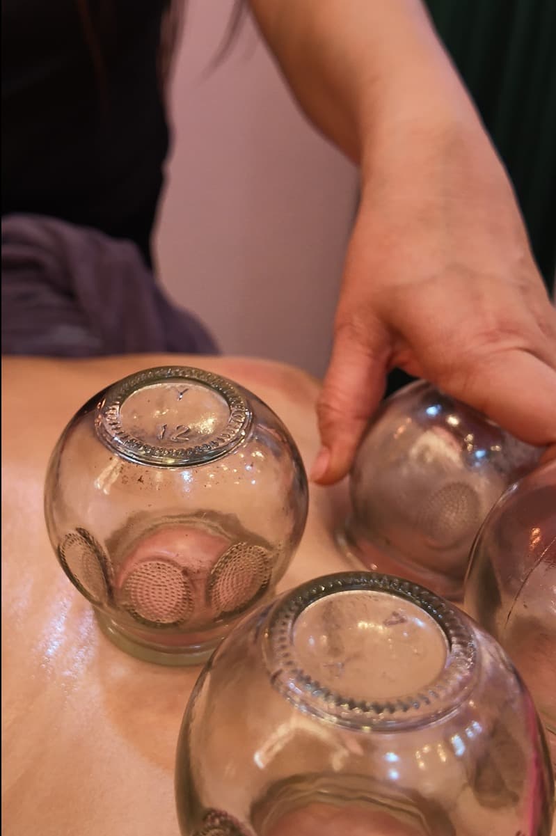 Cupping